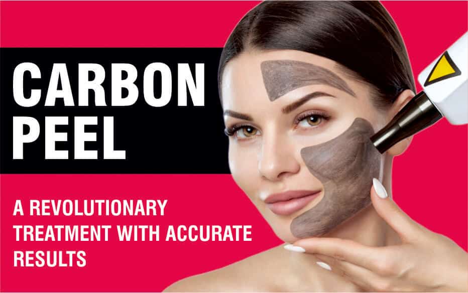 Carbon Peel - A revolutionary treatment with accurate results