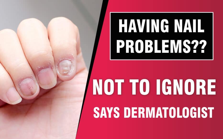 Ask a Dermatologist Online for Problem In Nail/finger