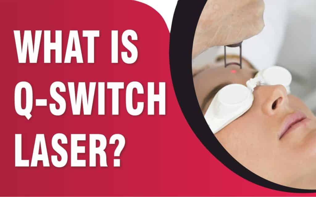 Q-Switch Lasers