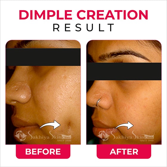 Before and After Result Of Dimple Creation