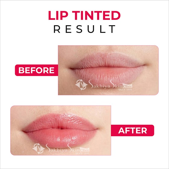 Before and After Result Of Lip Blush Treatment (3)